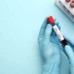 Scientist holding tube with blood sample and label STD Test on light blue background, top view.