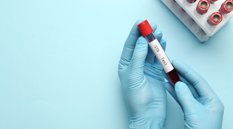 Scientist holding tube with blood sample and label STD Test on light blue background, top view.