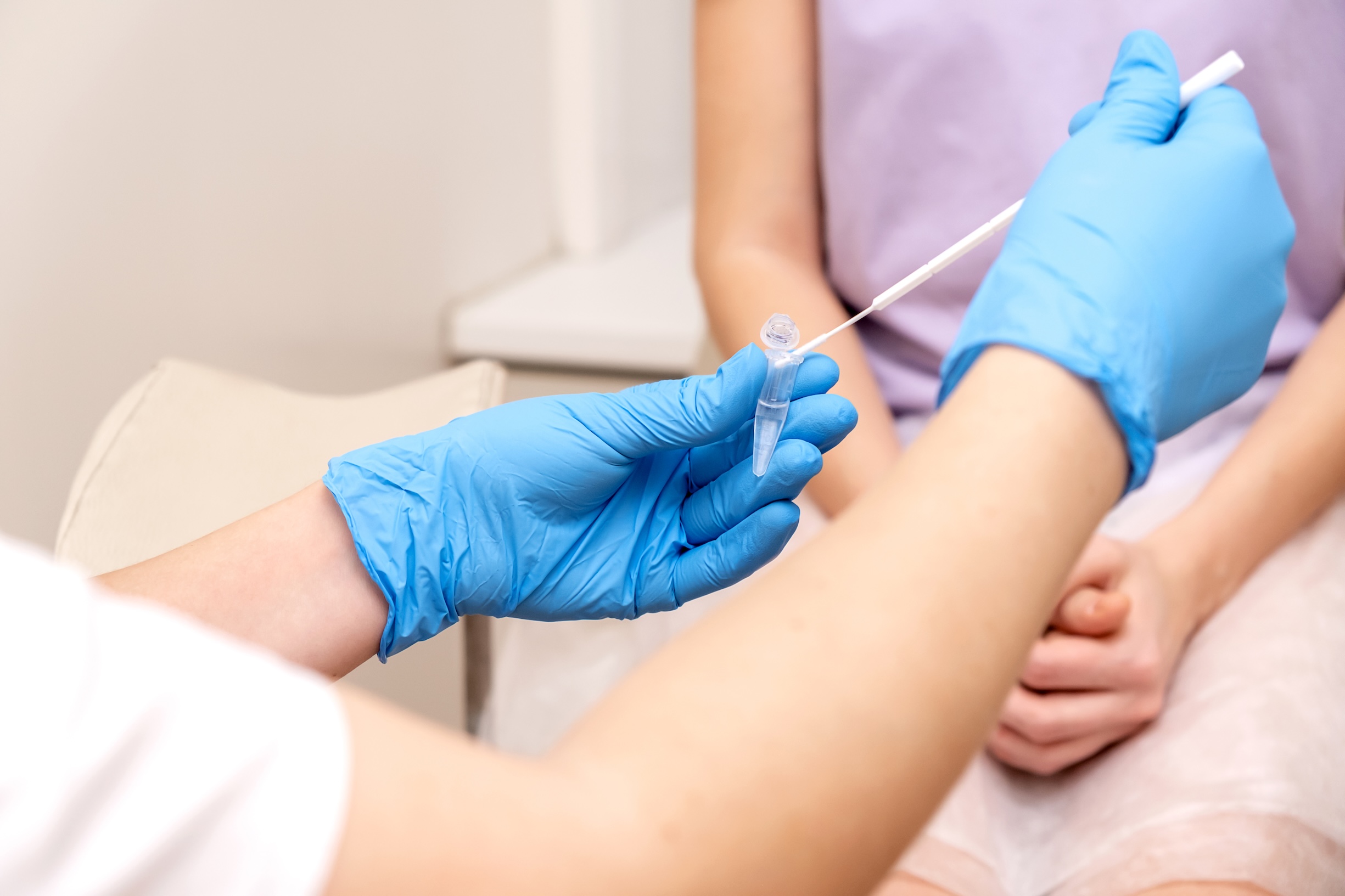 Gynecologist takes a swab for ureaplasma testing from a woman, placing the sample in the test tube.